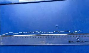 Giun rồng - mối nguy âm thầm có thể gây tử vong